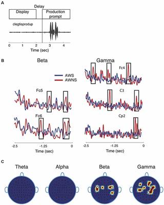 Theta Modulated Neural Phase Coherence Facilitates Speech Fluency in Adults Who Stutter
